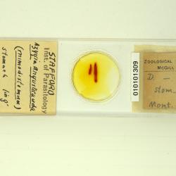 Azygia angusticauda